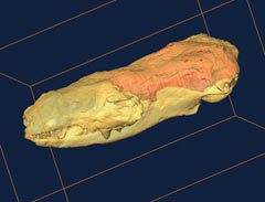 CT scan of the skull